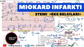 EKG Tahlili07  Miokard Infarkti  EKG Namunasi [upl. by Ahsaek952]