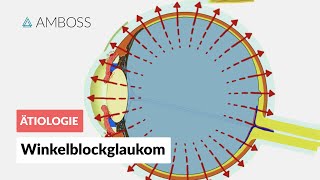 Akutes Winkelblockglaukom bei Pupillarblock  AMBOSS Video [upl. by Manvell397]