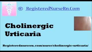 Cholinergic Urticaria [upl. by Jaclin]