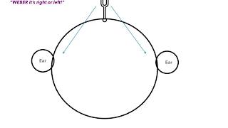 Weber vs Rinne Test amp Conductive vs Sensorineural Hearing Loss [upl. by Reedy130]