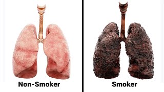 iQOS vs Traditional Regular Smoking  Lungs Harm Comparison [upl. by Pas]