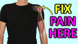 Front Shoulder Pain Fix the REAL cause of Biceps Tendonitis [upl. by Perkin]