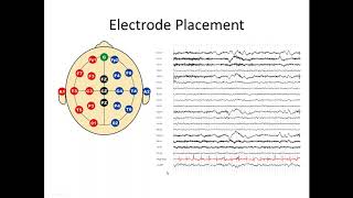 Understanding the EEG [upl. by Cadel310]