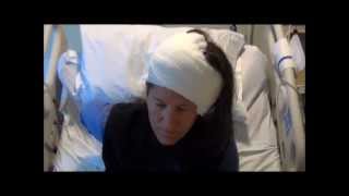 GBM Brain Tumor Surgery Survivor [upl. by Asik]