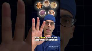 Doctor Sethi  5 Signs Your Body Needs More Nutrients ‼️🚨 [upl. by Idnir]