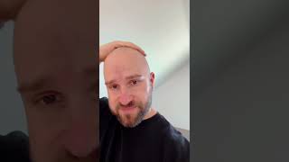 How to care your bald head 👨🏼‍🦲 bald glatze [upl. by Natty]