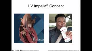 Impella What the Intensivist Needs to Know  Part 1 [upl. by Auahsoj277]