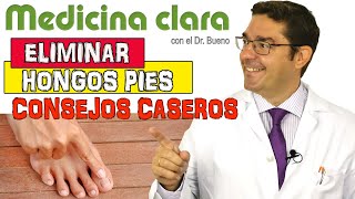 ELIMINAR LOS HONGOS EN PIES DESDE CASA  Medicina Clara [upl. by Ayad829]