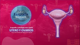 patologia basica mas comun del utero y ovarios por ecografia [upl. by Nisaj]