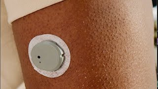 A 15day Dexcom G7 CGM is Coming dexcomg7 cgm diabetes [upl. by Guglielma764]