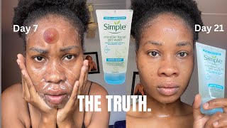 I TRIED Simple Micellar Facial Gel wash For 21 days and this happened Honest Review [upl. by Phi]