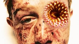 Trypophobia Eye 2016 [upl. by Alenson]