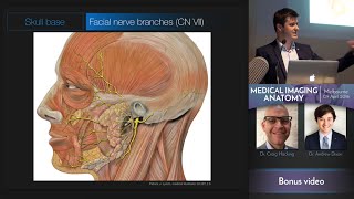 Facial Nerve  Medical Imaging Anatomy Course [upl. by Millie14]