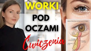 WORKI POD OCZAMI  jak zlikwidować [upl. by Groeg240]