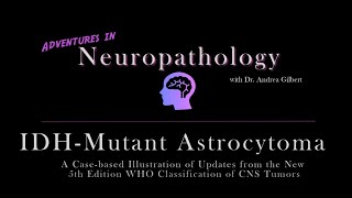 IDH  Mutant Astrocytoma Update from the 5th Edition WHO Classification of CNS Tumors [upl. by Lucienne]