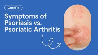 Psoriasis vs Psoriatic Arthritis Symptoms  GoodRx [upl. by Jacobo393]