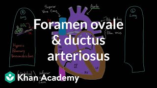 Foramen ovale and ductus arteriosus  Circulatory system physiology  NCLEXRN  Khan Academy [upl. by Aiela]