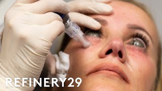 The Truth About This Controversial Injection Trend  Shady  Refinery29 [upl. by Yllet]