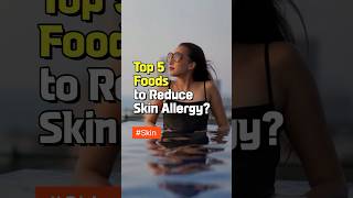 Top 5 Foods to Reduce Skin Allergy  How to Eat  healthy food fact  nutrition after age 50 food [upl. by Eisse]