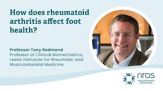 How does rheumatoid arthritis affect foot health  RheumZoom  June 2022 [upl. by Anaahs]