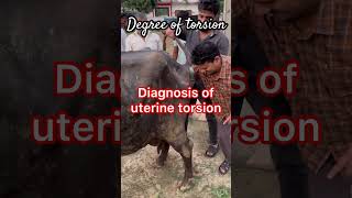 Degree of uterine torsion l dr Umar khan [upl. by Salocin366]