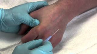 Intravenous Catheter Placement [upl. by Anihcak]