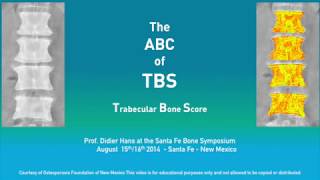 Prof Didier Hans lecture on TBS [upl. by Ojeitak]