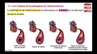 vidéo 1 sur le chapitre C4 3 lathérosclérose et les insuffisances coronariennes [upl. by Hamehseer]