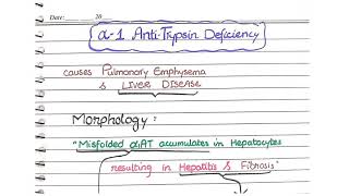 Alpha 1 Antitrypsin deficiency  Liver Pathology  Morphology [upl. by Irisa795]