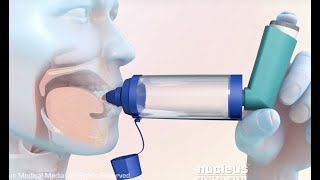 How to Use a Metered Dose Inhaler with a Spacer [upl. by Terrye]