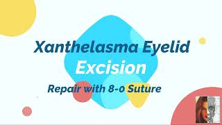 Xanthelasma Eyelid Excision [upl. by Gilletta]