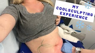 MY COOLSCULPTING EXPERIENCE and GIVEAWAY  Before amp Afters  KelseyRae Mua [upl. by Radman]