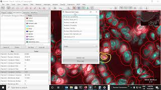 3  Analysis  Warpy Whole Slide Images Registration with QuPath and Fiji [upl. by Ysor557]