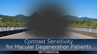 Contrast Sensitivity for Macular Degeneration Patients [upl. by Euqor]