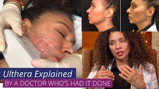 Ulthera aka Ultherapy  Explained by a Doctor whos had Ulthera herself [upl. by Ahseikal482]