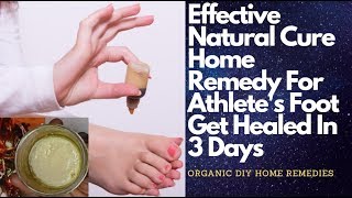 Athletes Foot Cure Home Remedy How To Cure Athletes Foot At Home In 3 Days DIY Ginger Foot Balm [upl. by Eikceb]