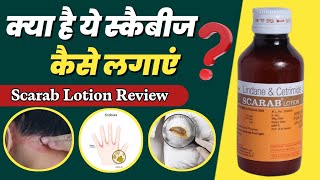 Scarab Lotion Kaise Lagaye  Lindane And Cetrimide Lotion  Scabies Aur Khujli Ke Liye Scarab Lotion [upl. by Elleyoj]