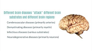 Neurodegenerative Diseases of the Brain [upl. by Onileba]