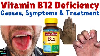 Vitamin B12 Deficiency – Symptoms Causes Diagnosis Treatment amp Prevention  Cobalamin Deficiency [upl. by Adrian626]