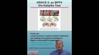 50 What is the Dix Hallpike test as discussed in the GRACE 3 guidelines [upl. by Pomeroy]