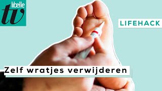 Zelf wratjes verwijderen  Libelle Lifehack [upl. by Arracot369]