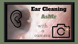 Ear  Pore Cleaning with a camera ASMR [upl. by Musser]