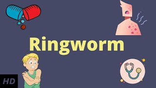 Ringworm Causes Signs and Symptoms Diagnosis and Treatment [upl. by Ahsinal572]