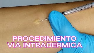 🔴DEMOSTRACIÓN 💉 VIA INTRADERMICA Administración de medicamentos Cofia Educativa [upl. by Aettam354]