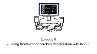 INVOS™ oximetry in the NICU Byte 8 Guiding treatment of cerebral desaturation with INVOS™ oximetry [upl. by Miahc910]