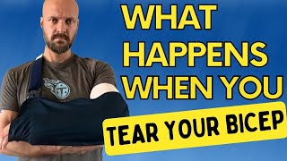 Bicep Tendon Tear Symptoms Diagnosis and Treatment Options [upl. by Eelano782]