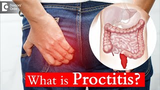 Proctitis Causes Treatment and Surgery  Dr Rajasekhar M R  Doctors Circle [upl. by Cathryn149]