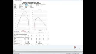 HUMAC NORM Test Procedure amp Reports [upl. by Anirehtak941]