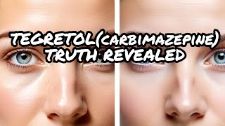 The Shocking truth about Tegretolcarbamazepine [upl. by Notxam157]