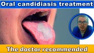 Oral candidiasis treatments [upl. by Ylrak]